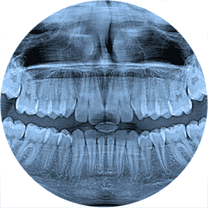 3D Cone Beam Dental Xray