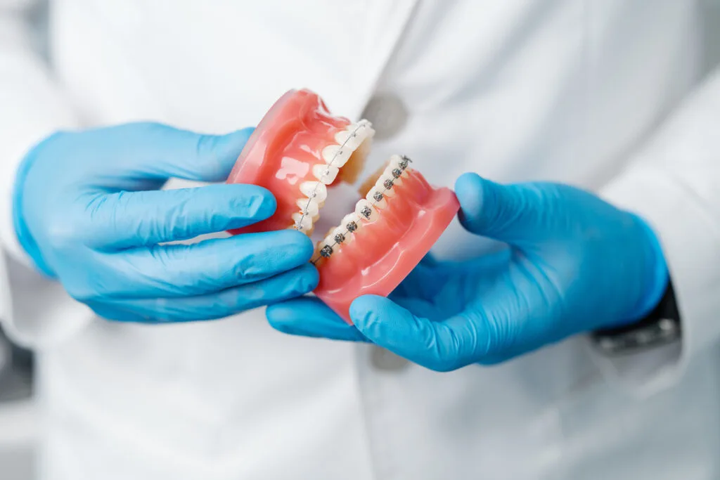 Orthodontic-treatment-1024x683.jpeg (1)